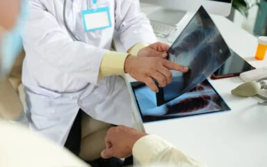 Doctor pointing at patient's X rays